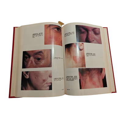 Atlas of Tumors of the Skin 1978 By Kopf, Bart, Andrade | Dermatology Hardcover