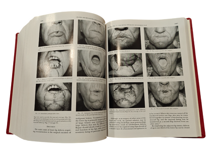 Plastic and Reconstructive Surgery Vol 100 No.1–7 1997 Hardcover Medical Journal