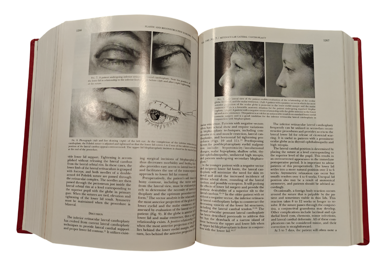 Plastic and Reconstructive Surgery Vol 100 No.1–7 1997 Hardcover Medical Journal