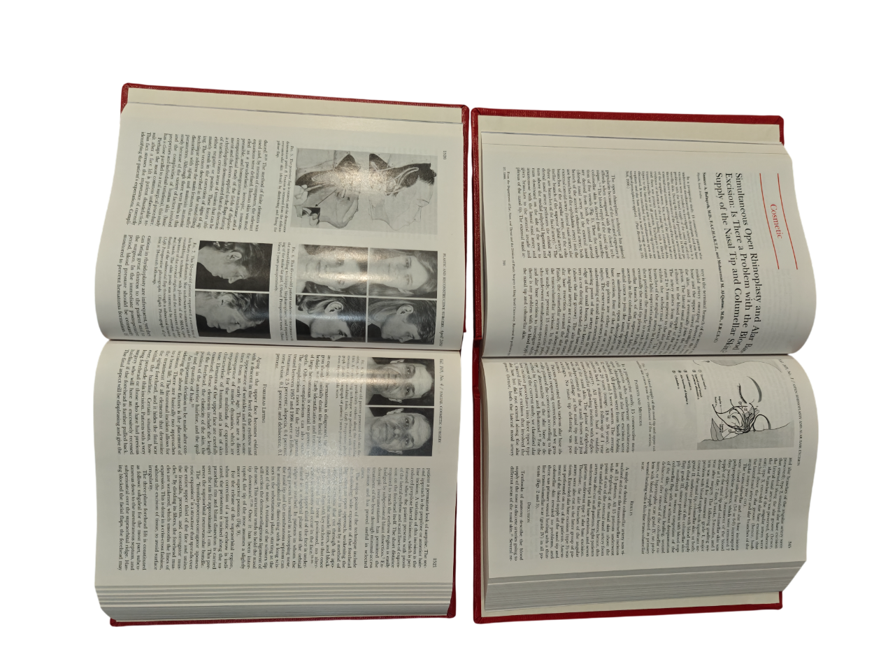 Plastic and Reconstructive Surgery Vol 105 2000 Medical Journal 2-Book Hardcover