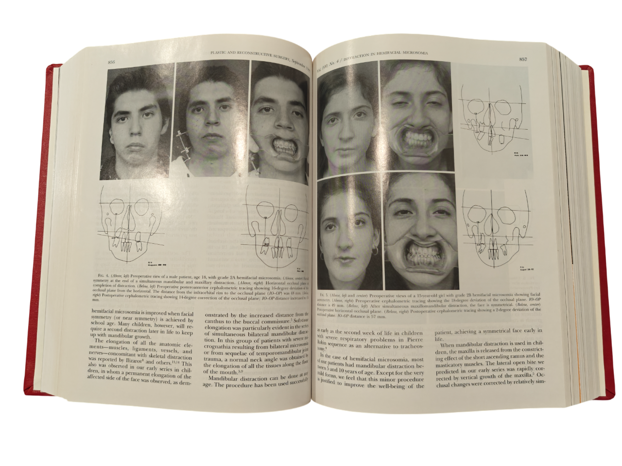 Plastic and Reconstructive Surgery Vol 100 No.1–7 1997 Hardcover Medical Journal