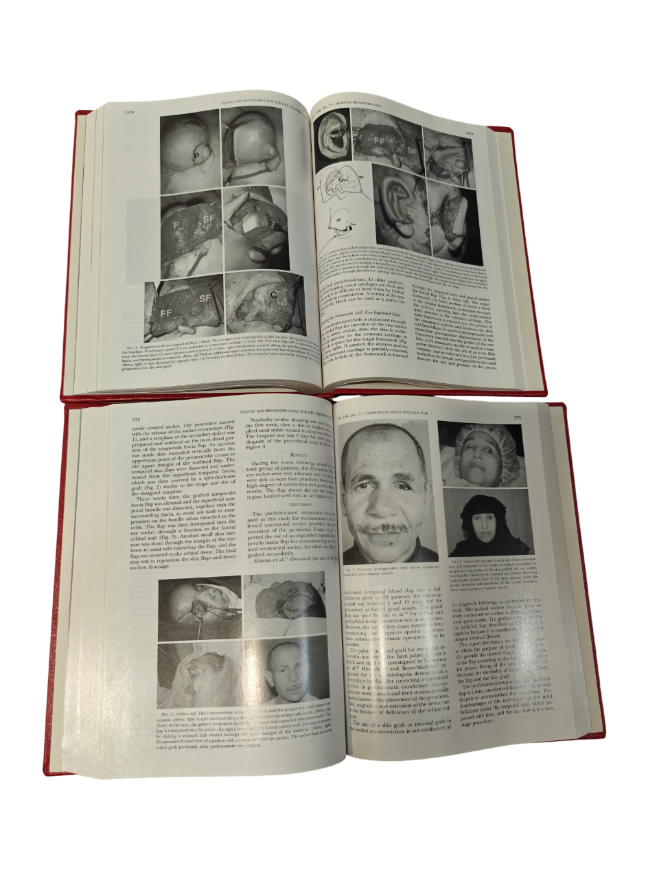 Plastic and Reconstructive Surgery Vol 106 2000 Medical Journal 2-Book Hardcover
