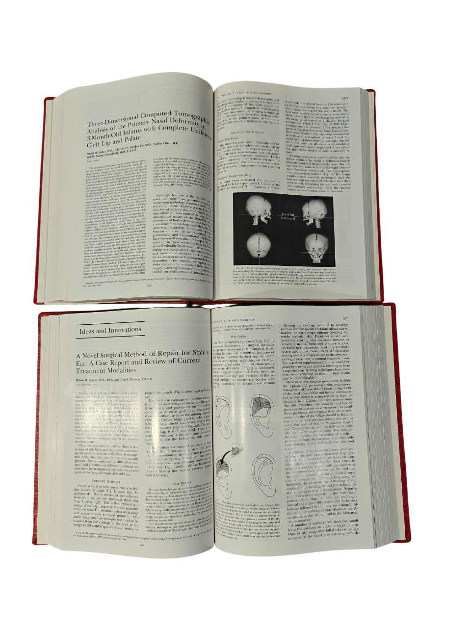 Plastic and Reconstructive Surgery Vol 103 1999 Medical Journal 2-Book Hardcover