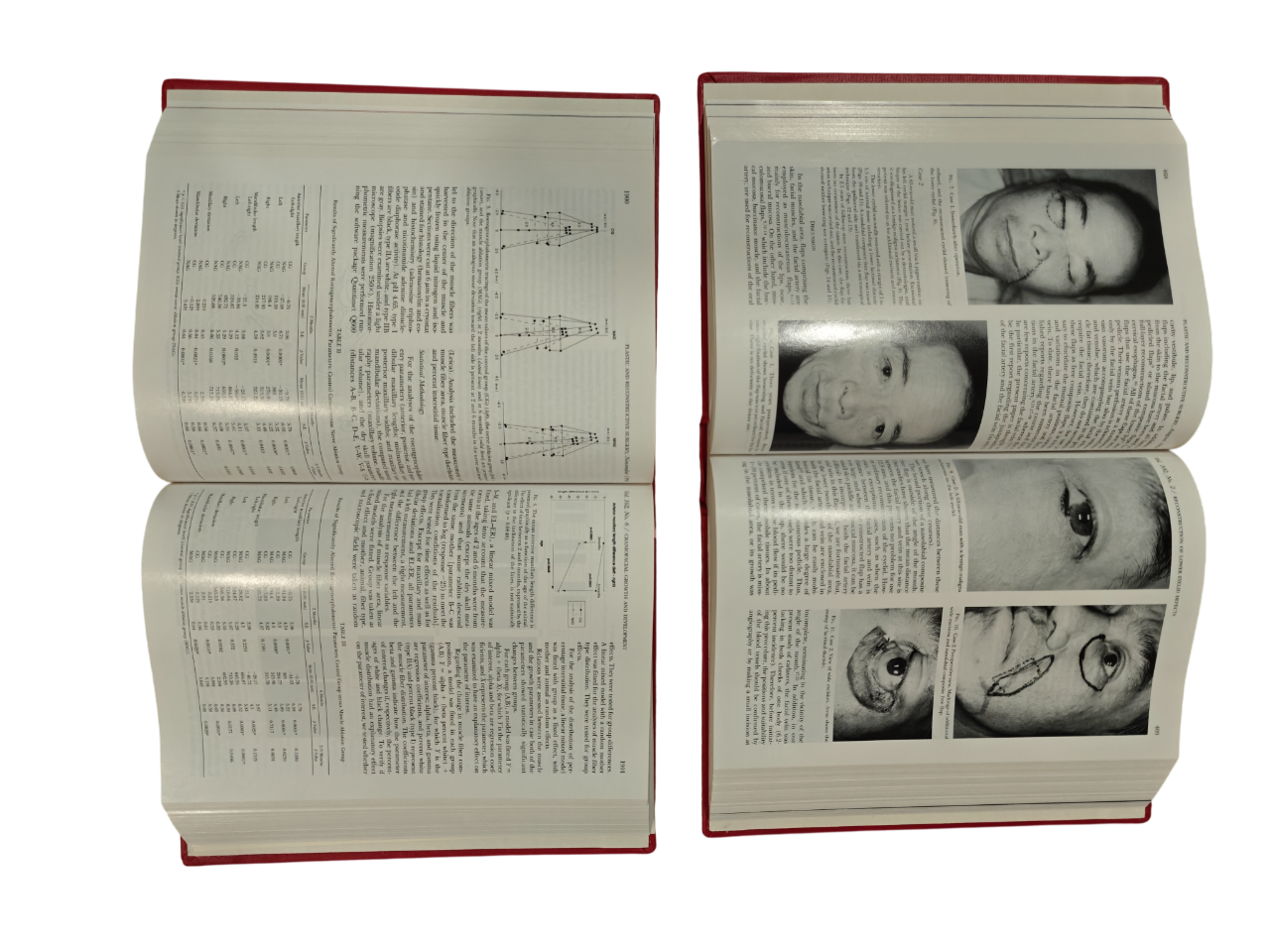 Plastic and Reconstructive Surgery Vol 102 1998 Medical Journal 2-Book Hardcover
