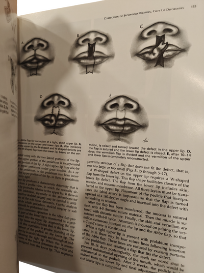 Surgical Techniques in Cleft Lip and Palate Medical Textbook by Bardach | Salyer