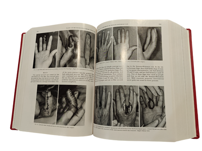 Plastic and Reconstructive Surgery Vol 99 Nos 1–7 1997 Hardcover Medical Journal