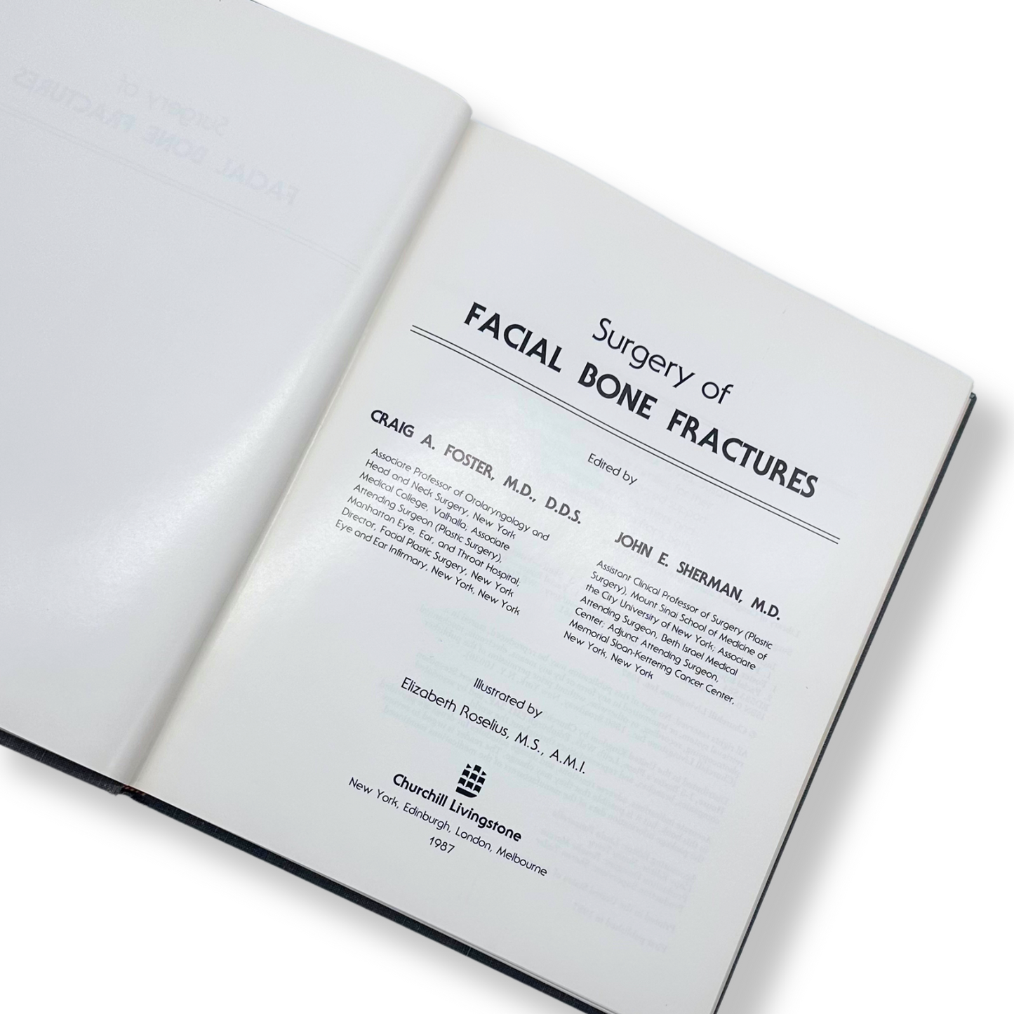 Surgery of Facial Bone Fractures | Craig A. Foster & John E. Sherman | Hardcover