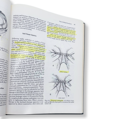 Surgery of Facial Bone Fractures | Craig A. Foster & John E. Sherman | Hardcover
