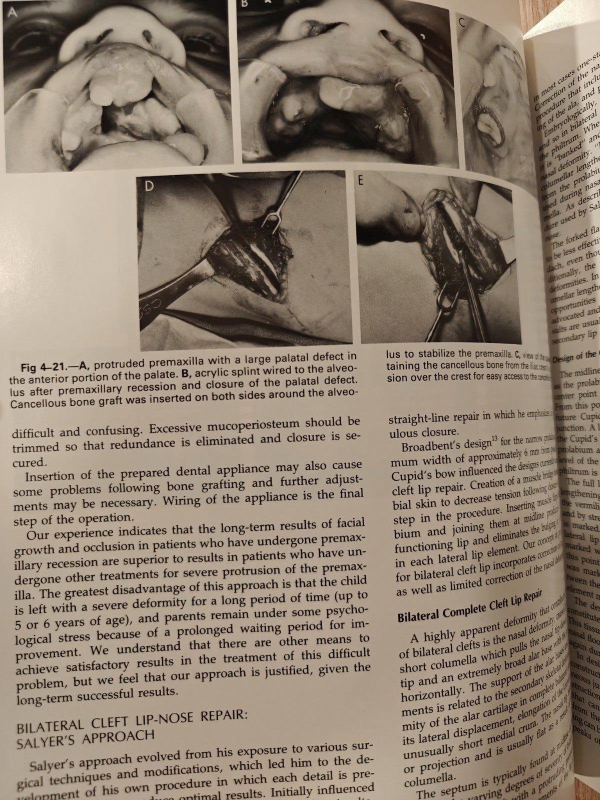 Surgical Techniques in Cleft Lip and Palate Medical Textbook by Bardach | Salyer