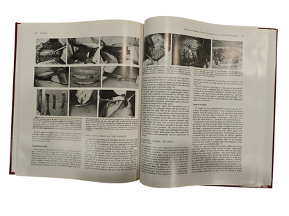 Surgical Techniques in Cleft Lip and Palate Medical Textbook by Bardach | Salyer