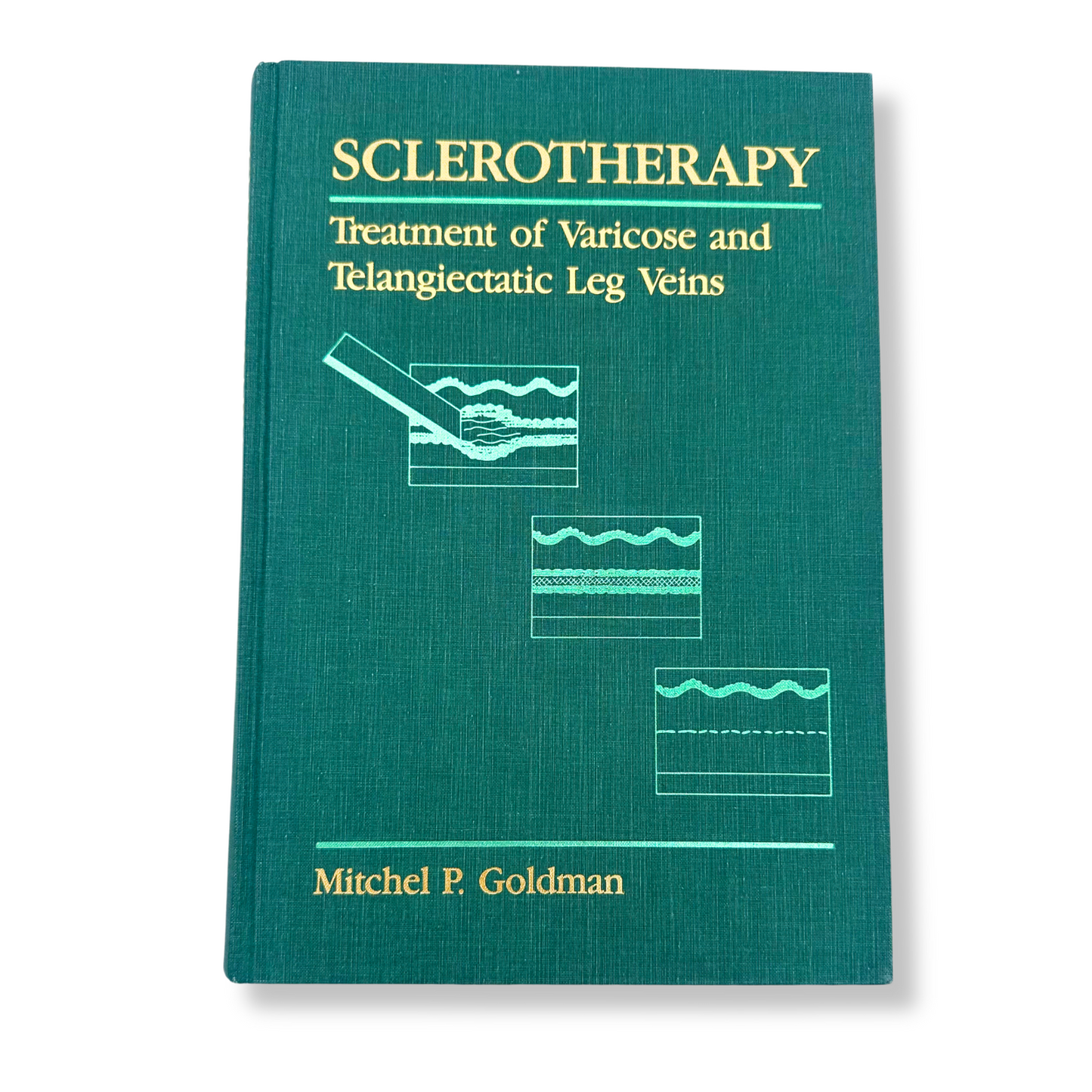 Sclerotherapy: Treatment of Varicose and Telangiectatic Leg Veins Hardcover Book