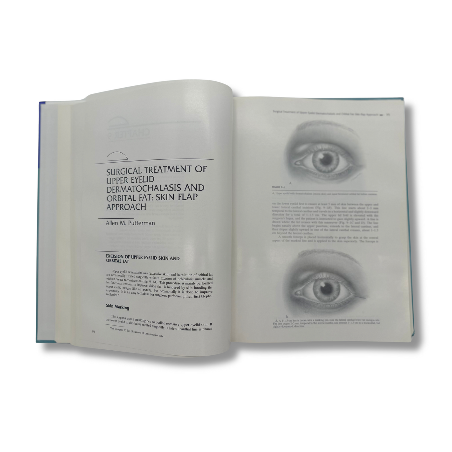 Cosmetic Oculoplastic Surgery  Second Edition Hardcover Textbook