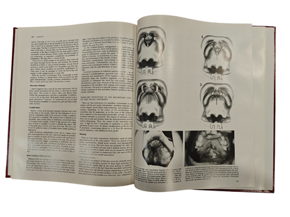 Surgical Techniques in Cleft Lip and Palate Medical Textbook by Bardach | Salyer