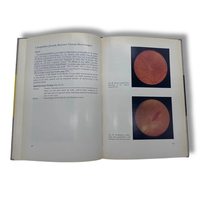 The Ocular Fundus by Arno Nover 1966 Illustrated English Translated Hardcover