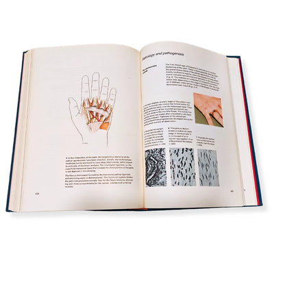 Tord Skoog Plastic Surgery: New Methods and Refinements 1974 Hardcover | RARE