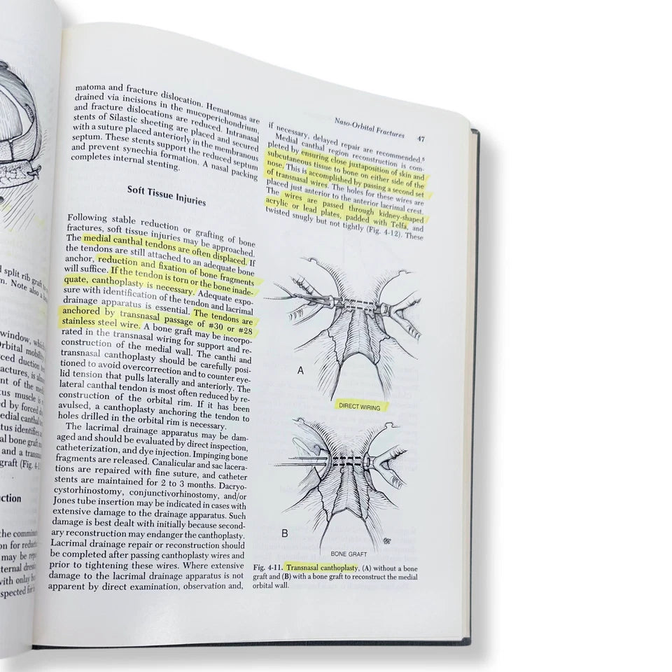 Surgery of Facial Bone Fractures | Craig A. Foster & John E. Sherman | Hardcover Textbook